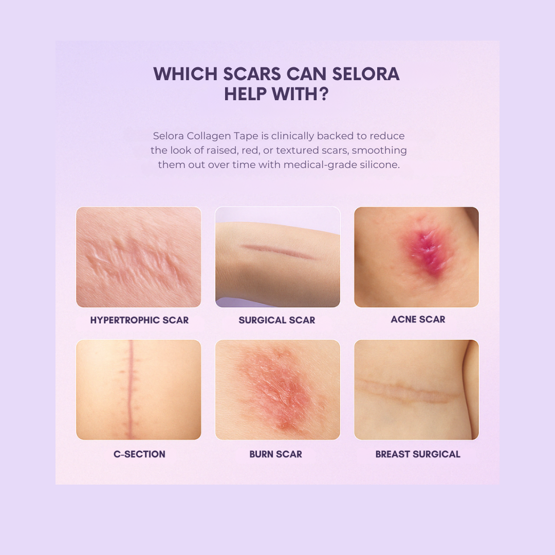 Selora™ Collagen Tape