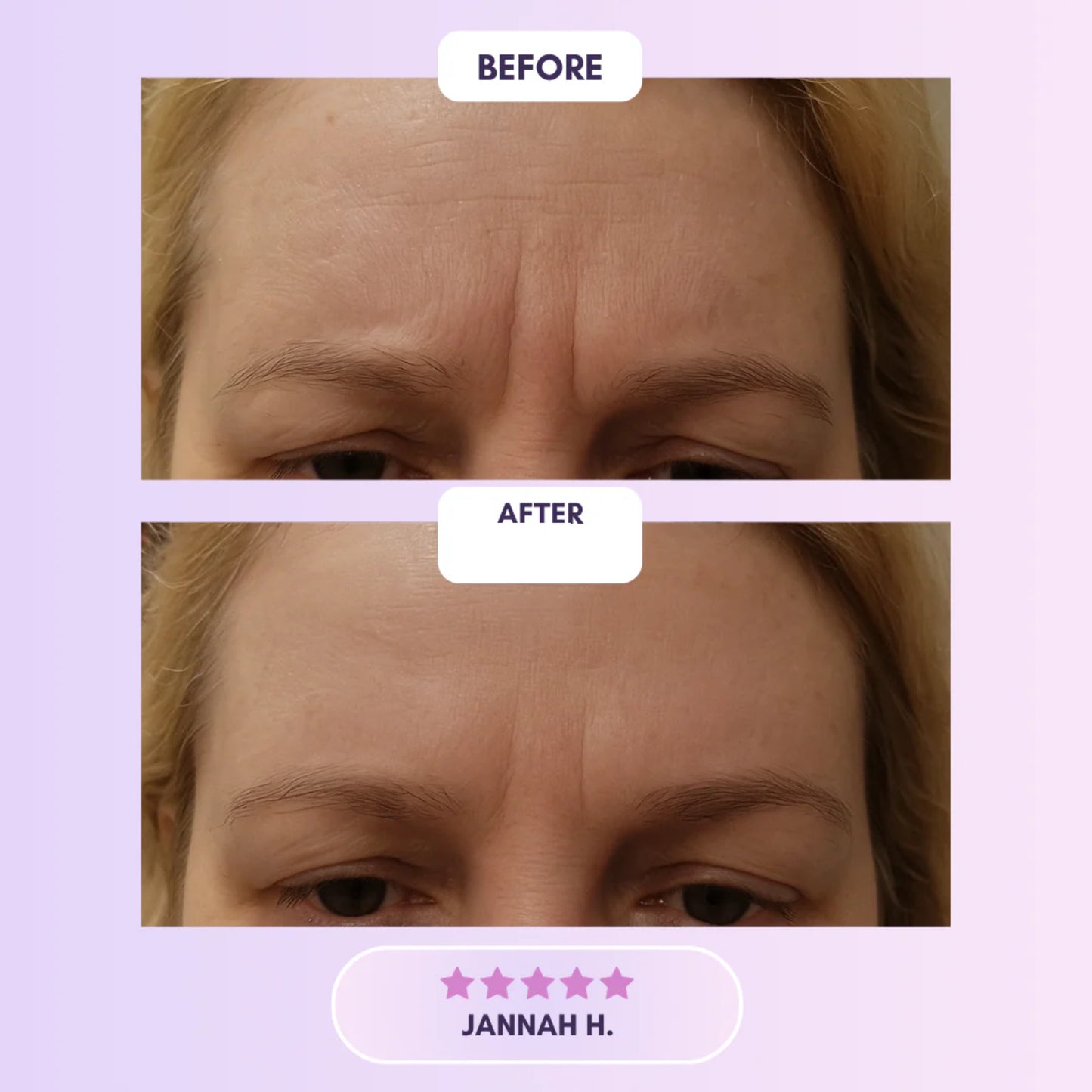 Selora™ Collagen Tape
