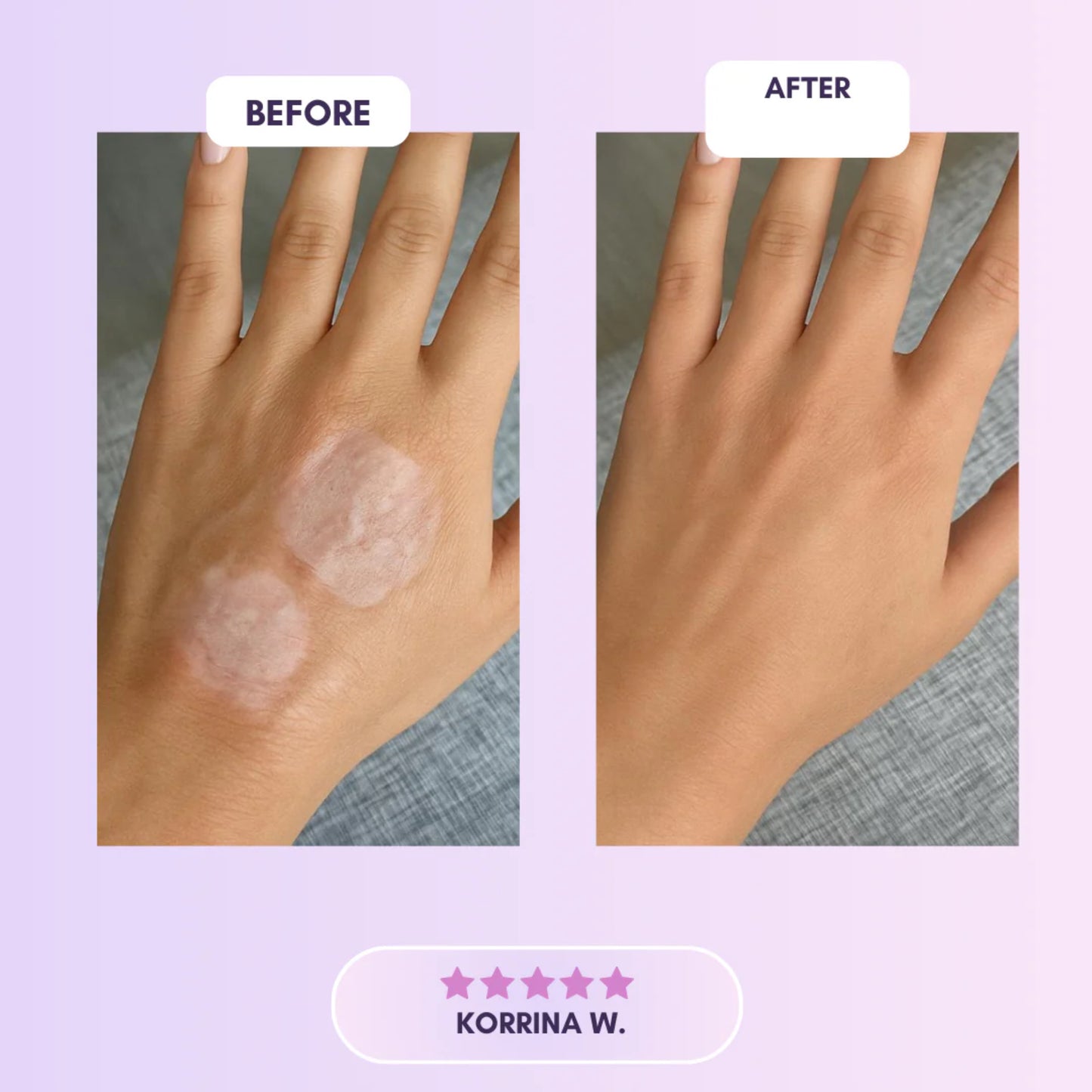 Selora™  Collagen Tape