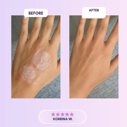 Selora™  Collagen Tape