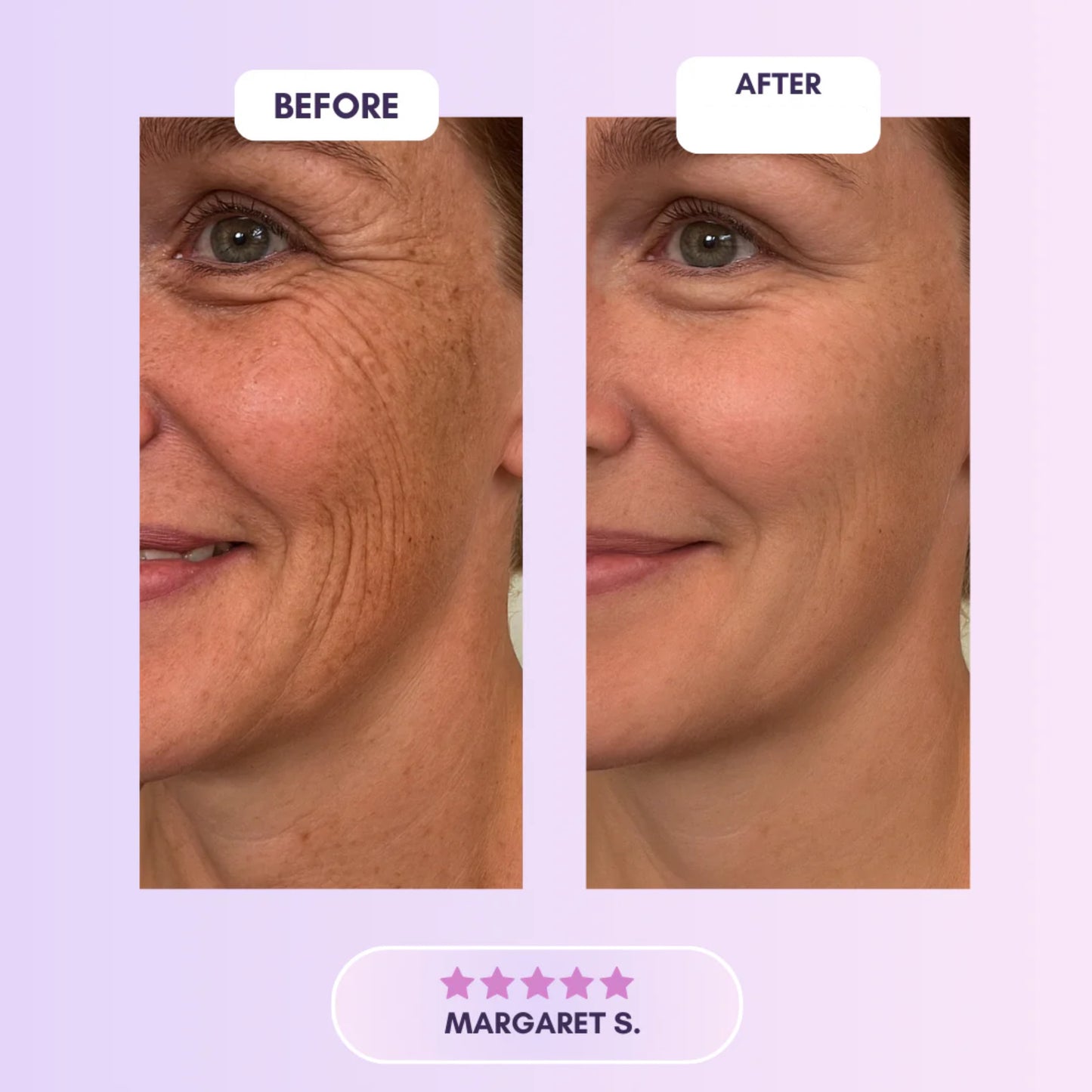 Selora™  Collagen Tape