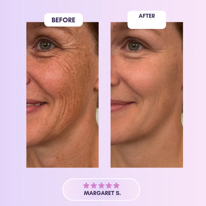 Selora™  Collagen Tape