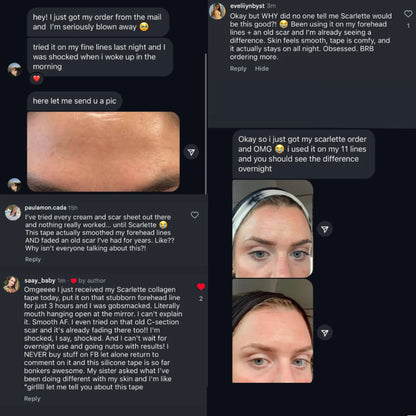 Selora™  Collagen Tape